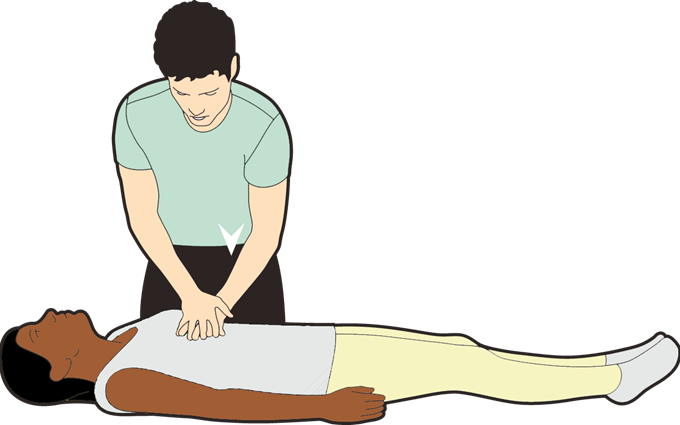 Adult CPR Adult CPR